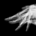 Jeux de mains, série ombres chinoises, tortue