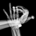 Jeux de mains, série danse de mains, CH06